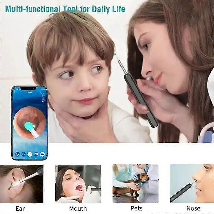 Wireless Smart Visual Ear Cleaner Usb WiFi Otoscope TW1 Ear Wax Removal Tool Set with Camera Ear Endoscope HD 1080P for iPhone iPad Android [db] — image 4