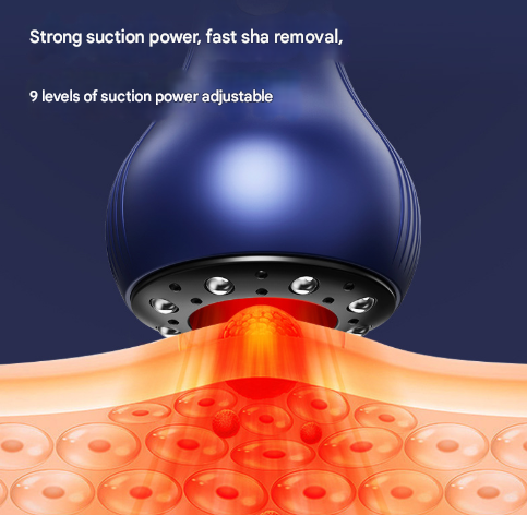 Blue Electric Meridian Scraping Massager with Air Release Valve - Full Body Suction Therapy, 16.6x8.4cm โ image 2