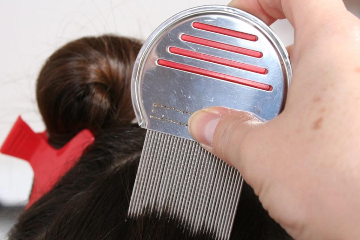 Stainless Steel Pet Flea Comb Fine Tooth Grooming Tool for Dogs Cats - Red โ image 5
