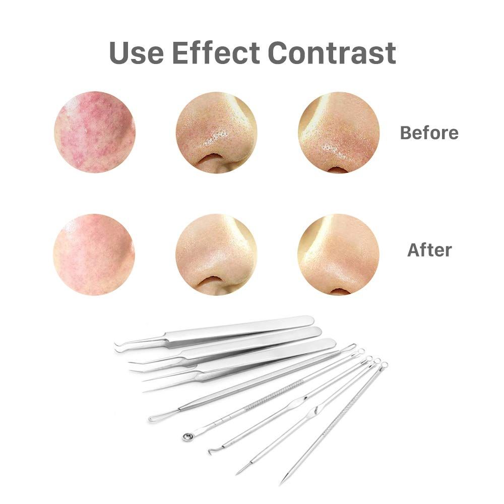 Pimple Popper Tool Acne Extractors Blemish Remover Ingrown Hair Tweezers Removal Kit Whitehead Remover 8-in-1 — image 2