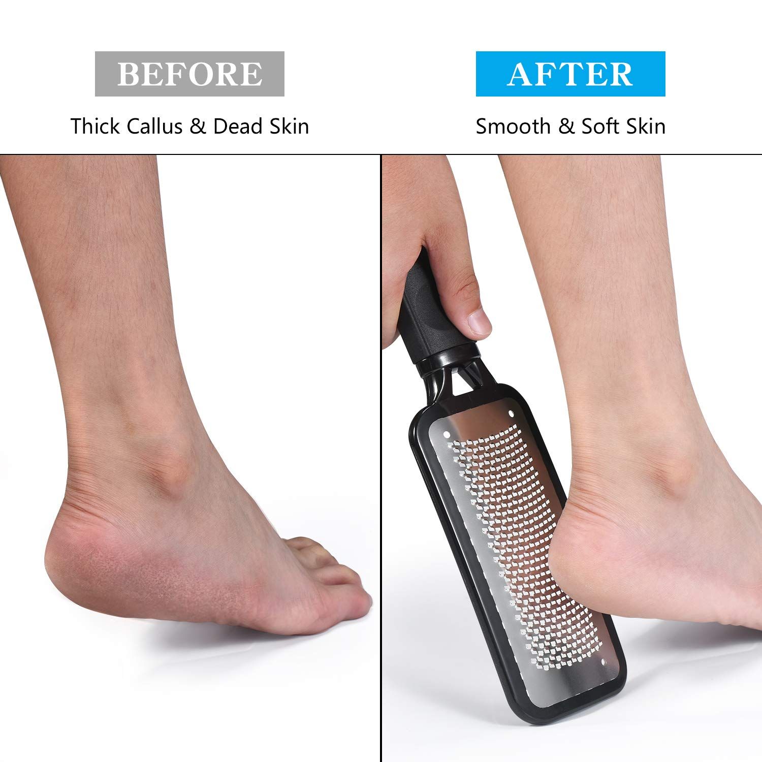 Foot Callus Remover Foot Scrubber Dead Skin Remover Foot File Heel Scraper for Cracked Heels Foot Exfoliator — image 4