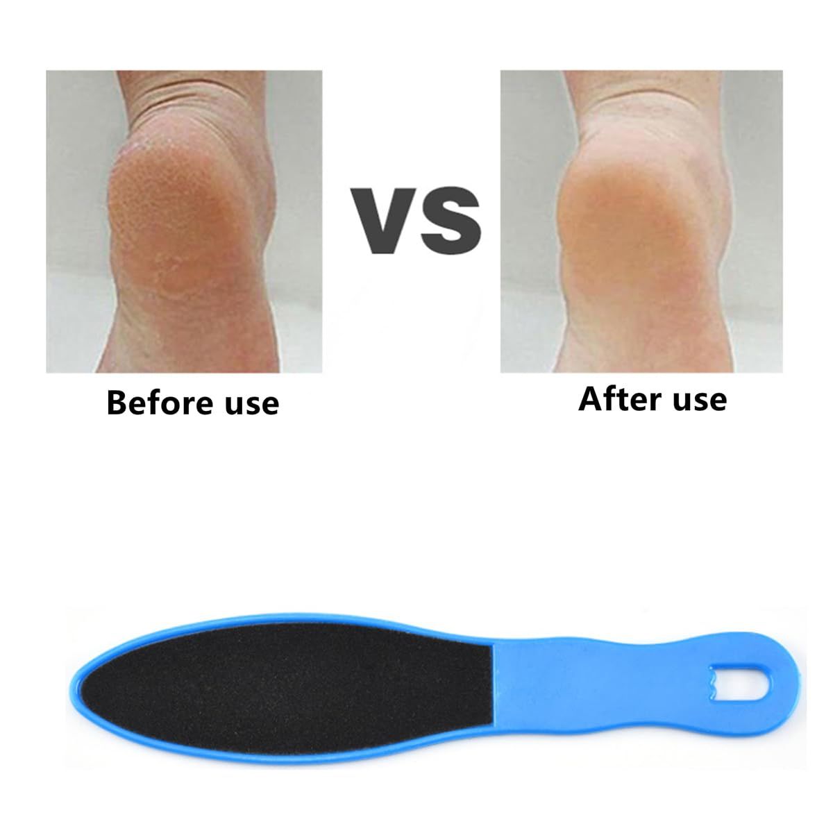 2pcs Double-Sided Foot Scraper, Reusable Foot File for Hard Skin Removal, Foot Scrubber for Wet Dry Cracked Heels — image 5