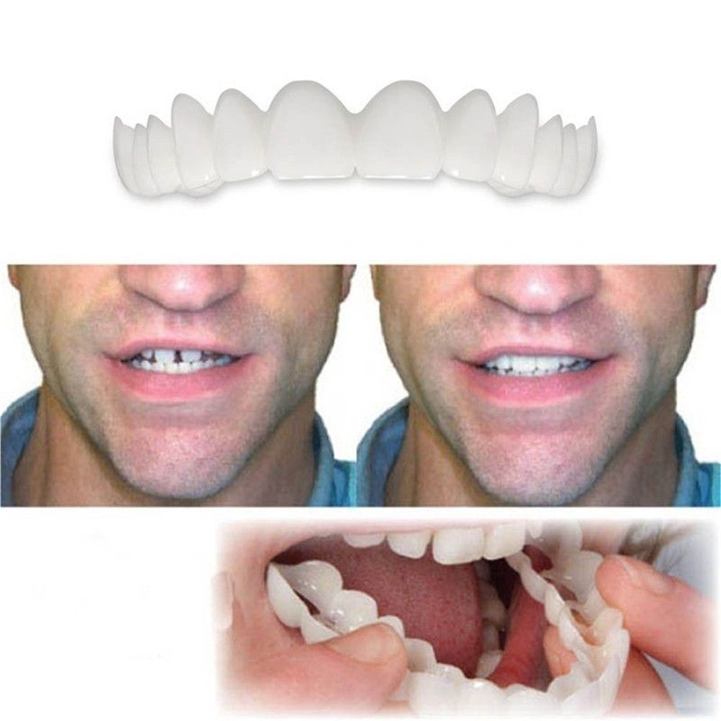Fake Teeth Denture Teeth Temporary Snap On Veneers Cover The Imperfect Teeth Fix Confident Smile Temporary Fake Teeth — image 5