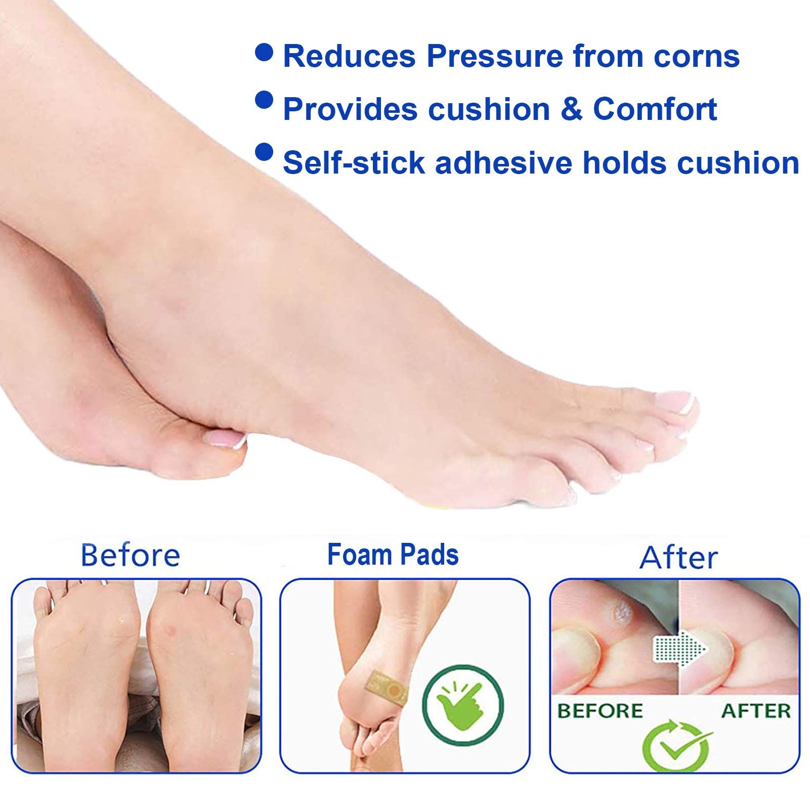 Toe and Callus Corn Removal — image 4