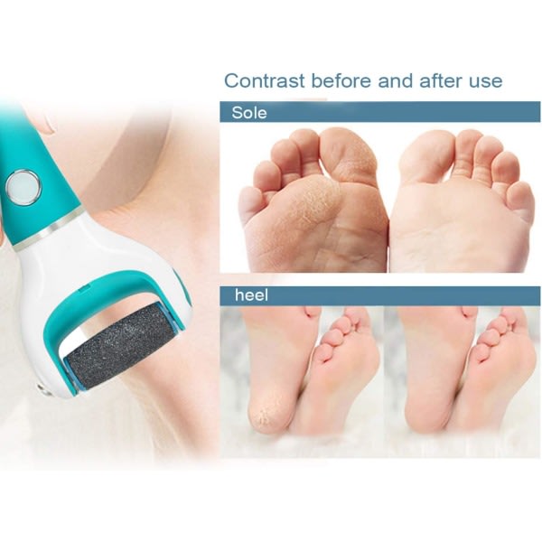 [9-pack] Scholl Velvet Smooth Pedi Replacement Rollers — image 6