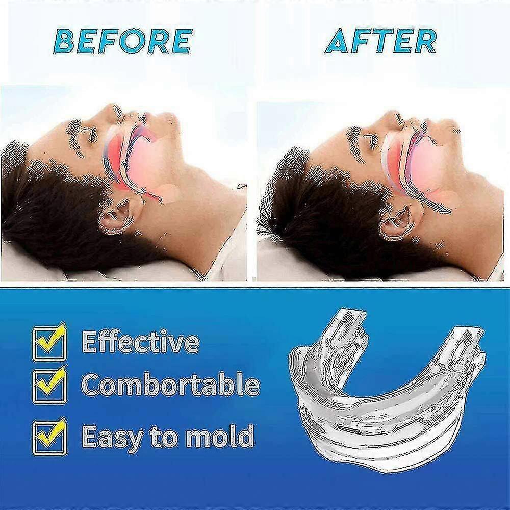 Adjustable Anti Snoring Mouthpiece Guard Anti Snore Sleep Apnea Teeth Grind — image 3