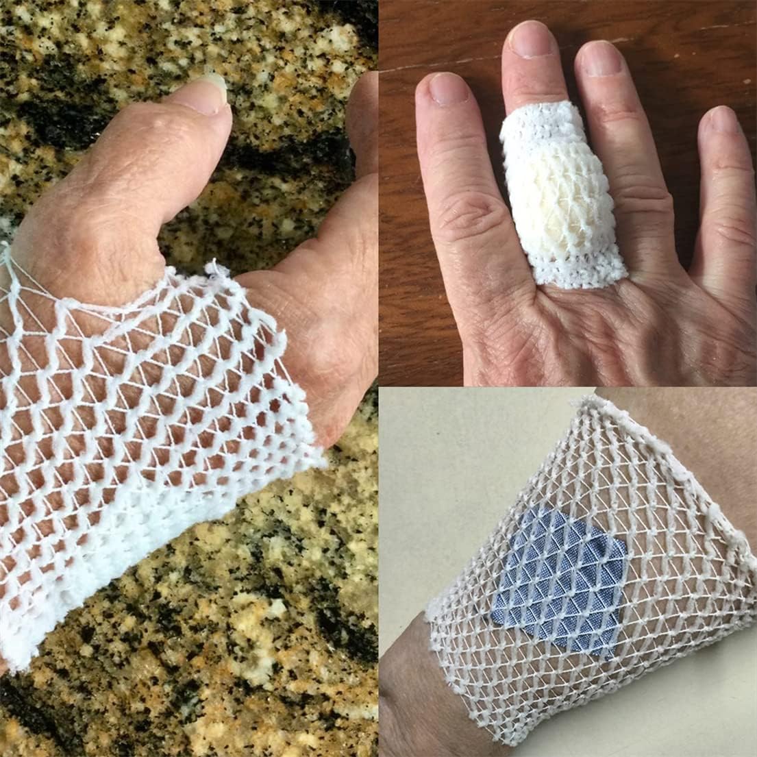 Tubular Bandage Elastic Net Bandages 7M Tubular Gauze Breathable Wound Dressing Wrap Retainer Stretch Bandage Support — image 6