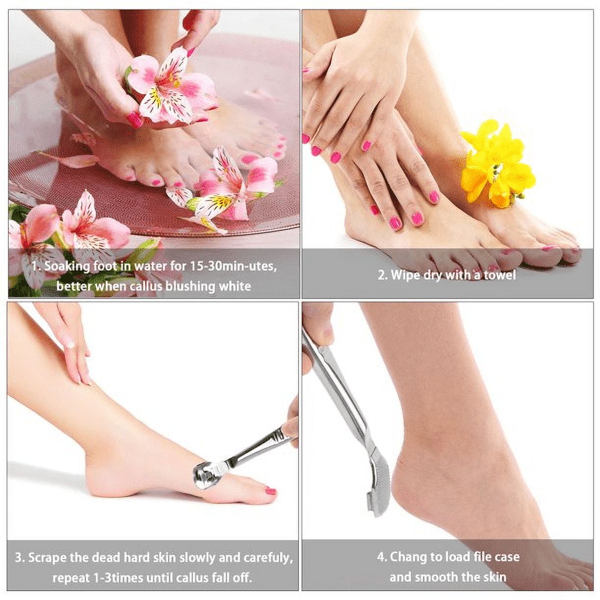 Foot Callus Shaver & Scraper Remover - Callous Removers for Feet Razor Tools with 10 Blades - Professional Pedicure Knife for Heel Hand Skin Care โ image 6