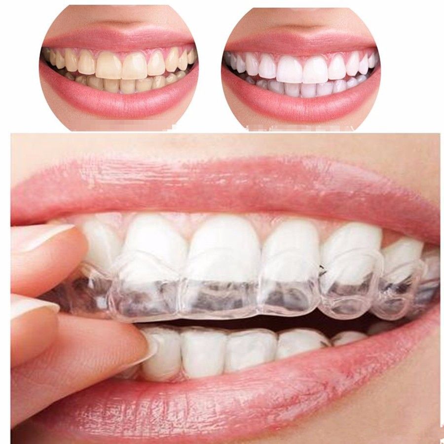Dental Retainer for Teeth โ image 2