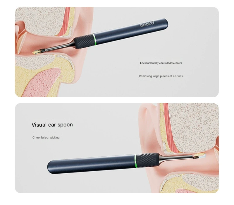 Smart Visual Ear Cleaner with HD Endoscope & Precision Tweezers - Safe for Adults & Children(White) — image 4