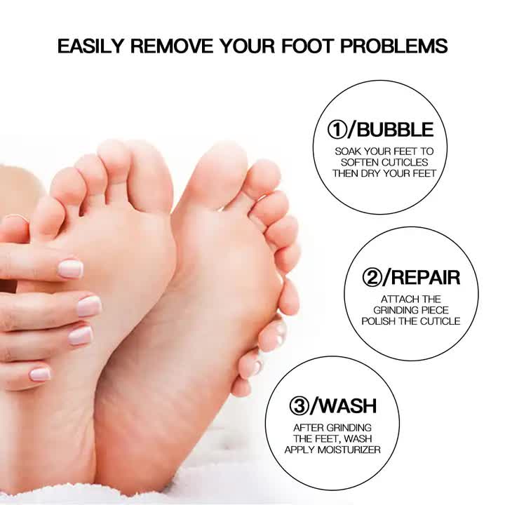 Silver Electric Foot Callus Remover - Portable Pedicure Tool for Smooth Feet โ image 5