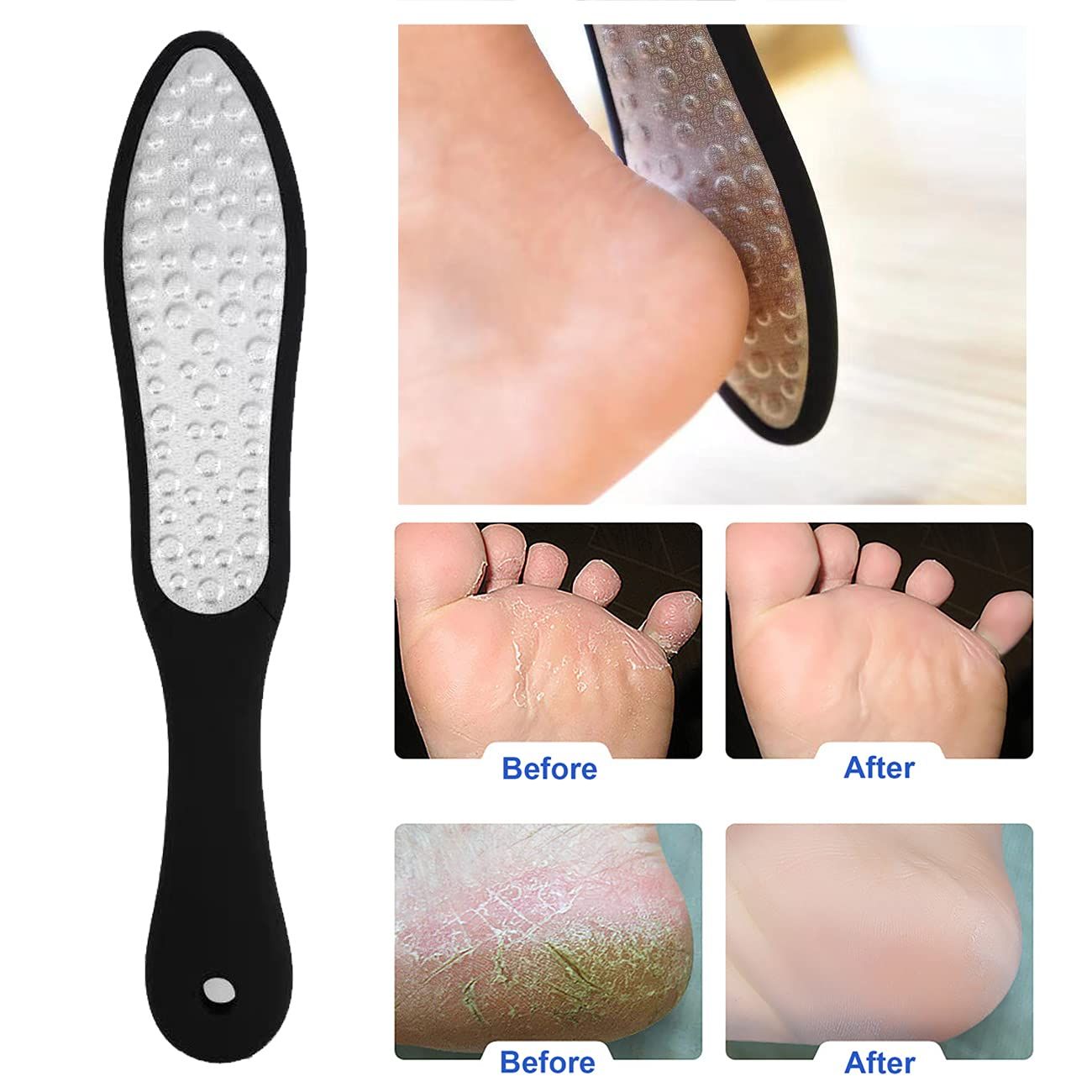 Files Callus Remover - Professional Foot Care Pedicure Stainless Steel File to Removes Hard Skin(Double-Sided Pointed) — image 4