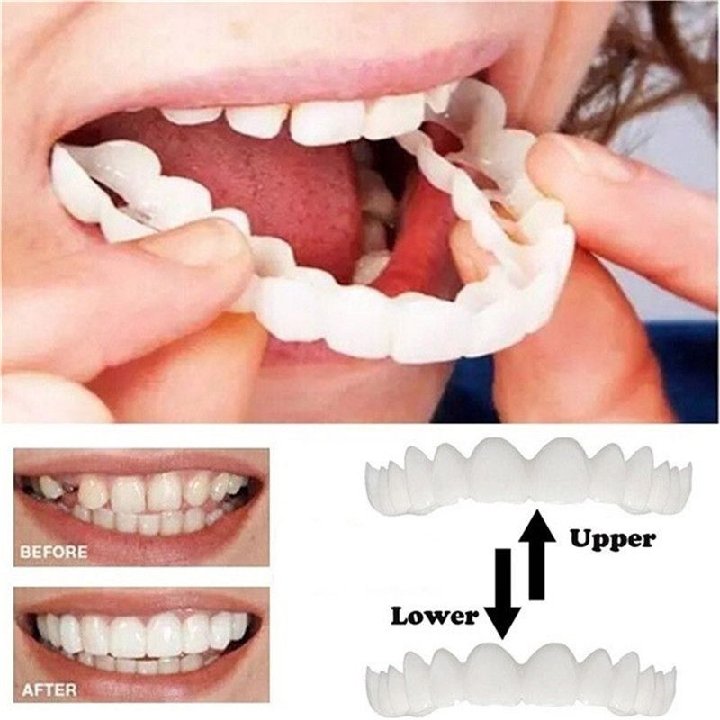 Fake Teeth Denture Teeth Temporary Snap On Veneers Cover The Imperfect Teeth Fix Confident Smile Temporary Fake Teeth — image 3