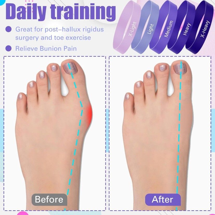 Lush Finger Tension Ring Bunion Corrector Set Dark purple finger tension ring arch training belt 15-20lbs โ image 5