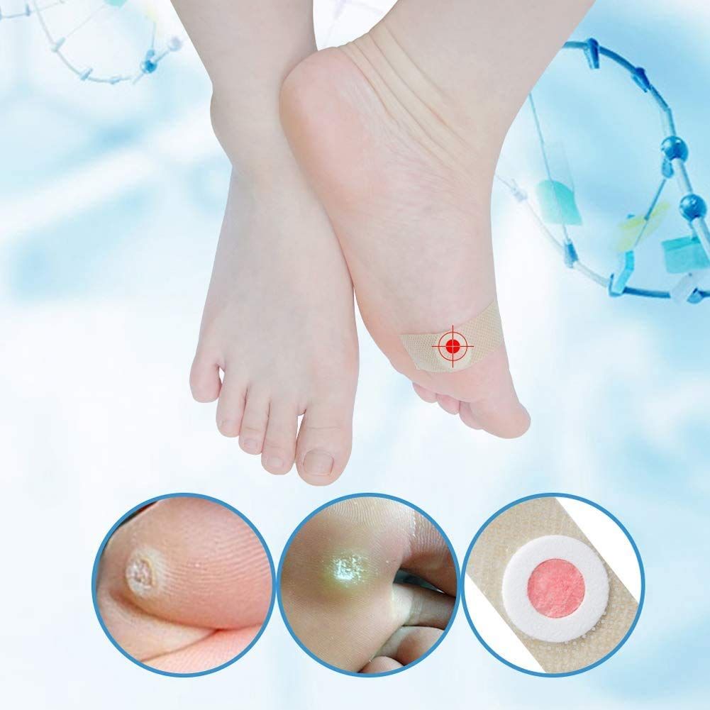 Toe and Callus Corn Removal