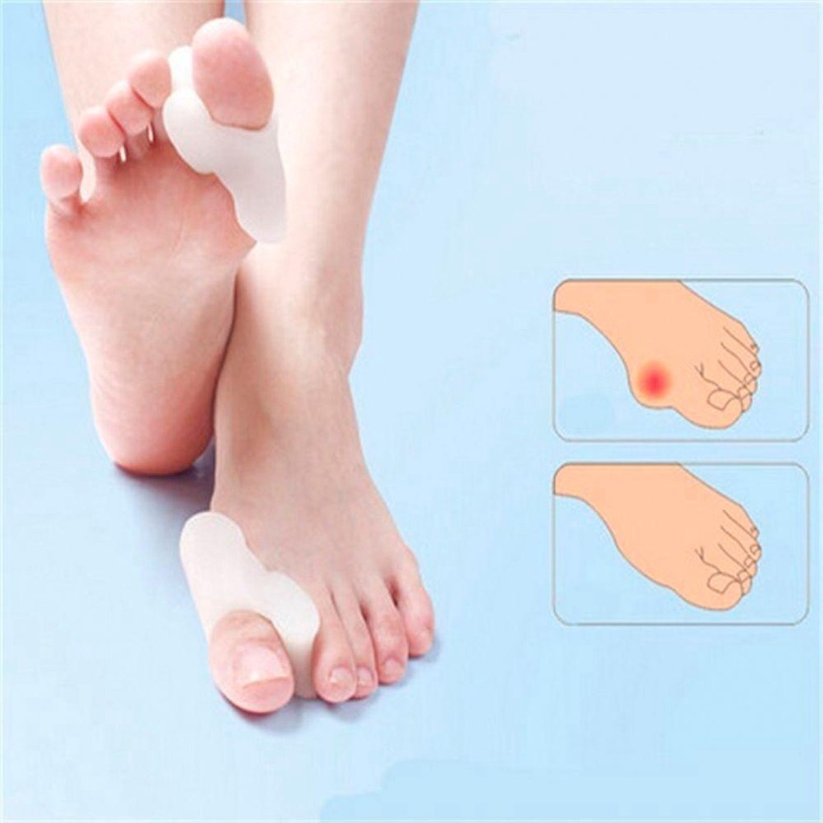 4x silicone big toe corrector/spreader (hallus valgus) — image 3