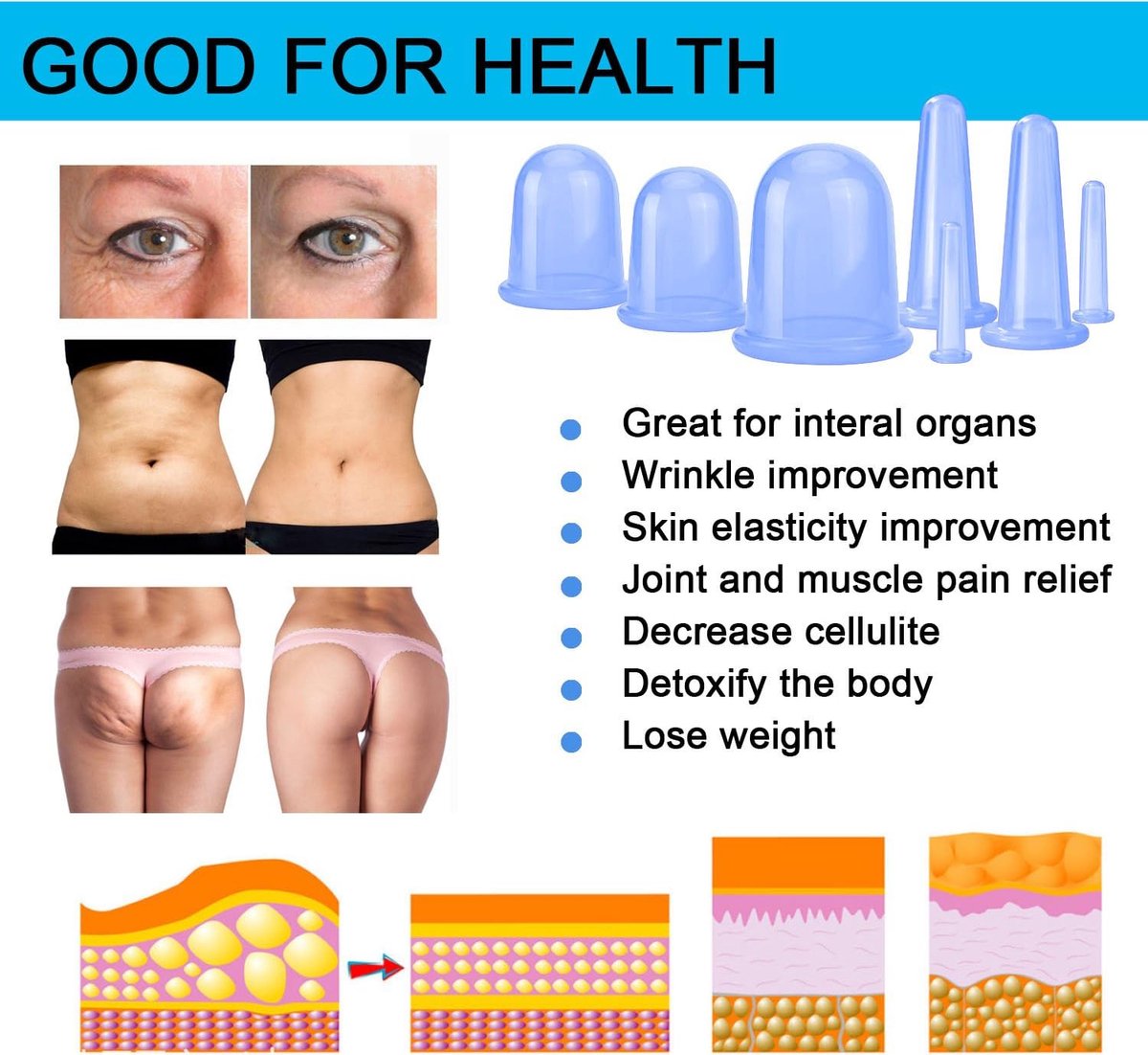Cellulite Cups - Cupping For Cellulite - Premium Quality Cupping Set (7-Piece) - Cupping Cups - Full Body - Cupping Cups Massage - For Face, Arms And Legs — image 2
