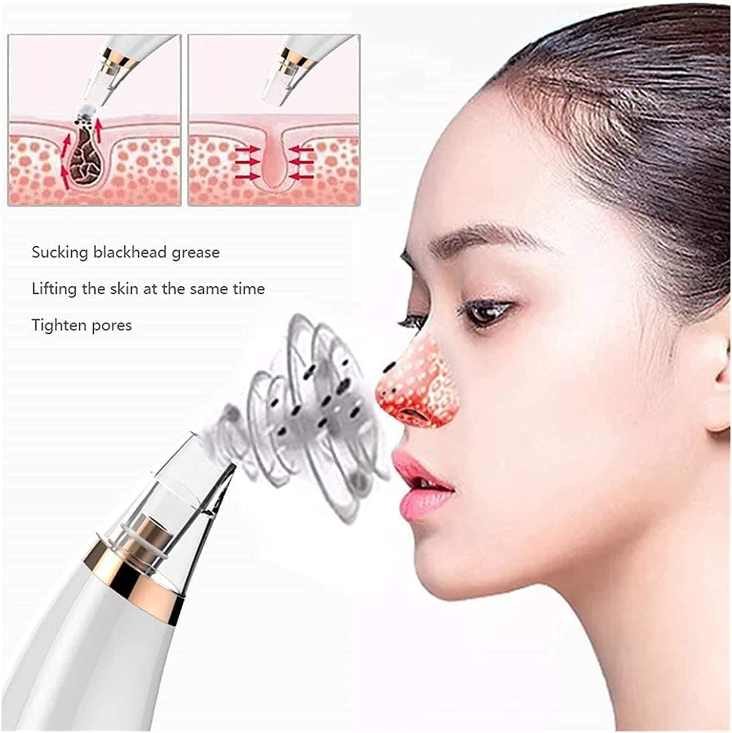 Pore Vacuum Blackheads Removed Upgraded Strong Suction Removing Black Heads Blackhead Removal Pimple for Women & Men — image 5