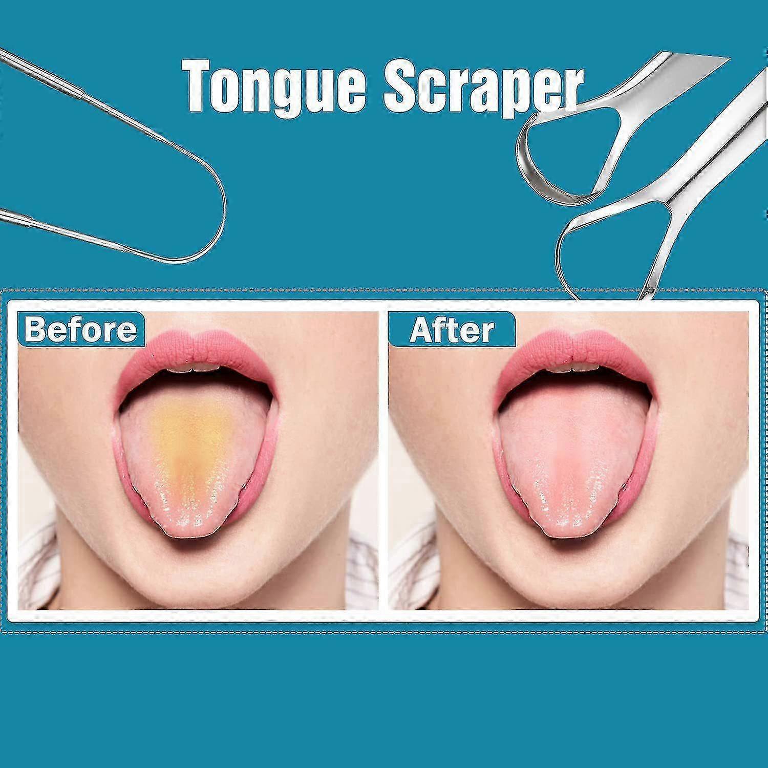 3 Pack Stainless Steel Tongue Scrapers, Portable Metal Tongue Cleaner for Oral Care โ image 5