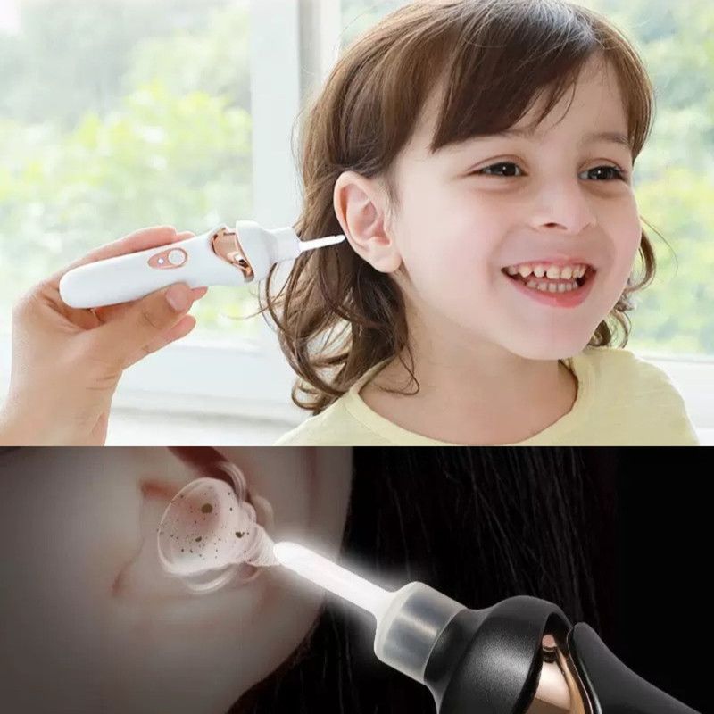 Electric Light-Up Earwax Remover, Self-Suction Ear Scoop Kit, Safe Ear Cleaning Tool for Kids & Adults—Black — image 3