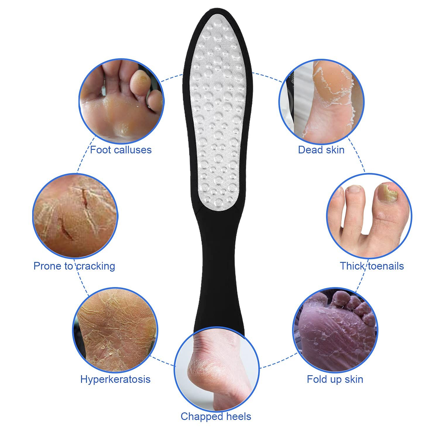 Files Callus Remover - Professional Foot Care Pedicure Stainless Steel File to Removes Hard Skin(Double-Sided Pointed) — image 3
