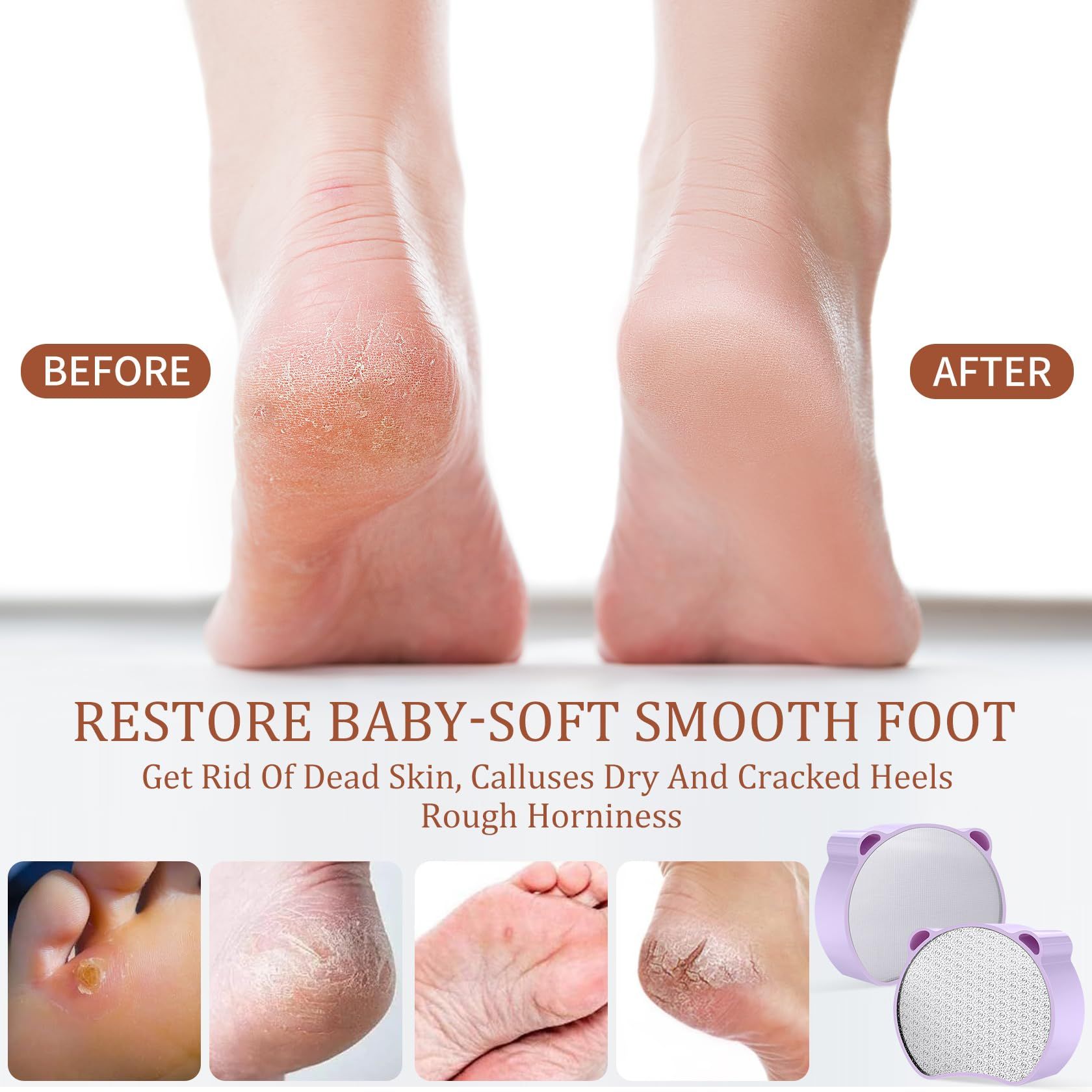 Hair Removal, Nail and Foot Beauty Tools, Double-Sided and Multifunctional. Compact and Portable, 1Pcs Purple — image 4