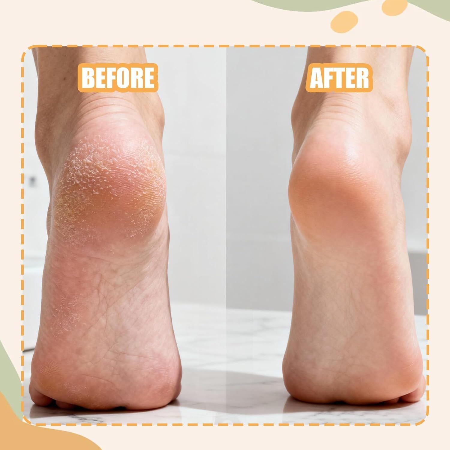 3PCS Precision Callus Remover & Bunion Scrubber for Toe Gaps, 2 Style Toe Callus Remover & Foot File Exfoliator with Compact Design for Pedicures and Sensitive — image 5