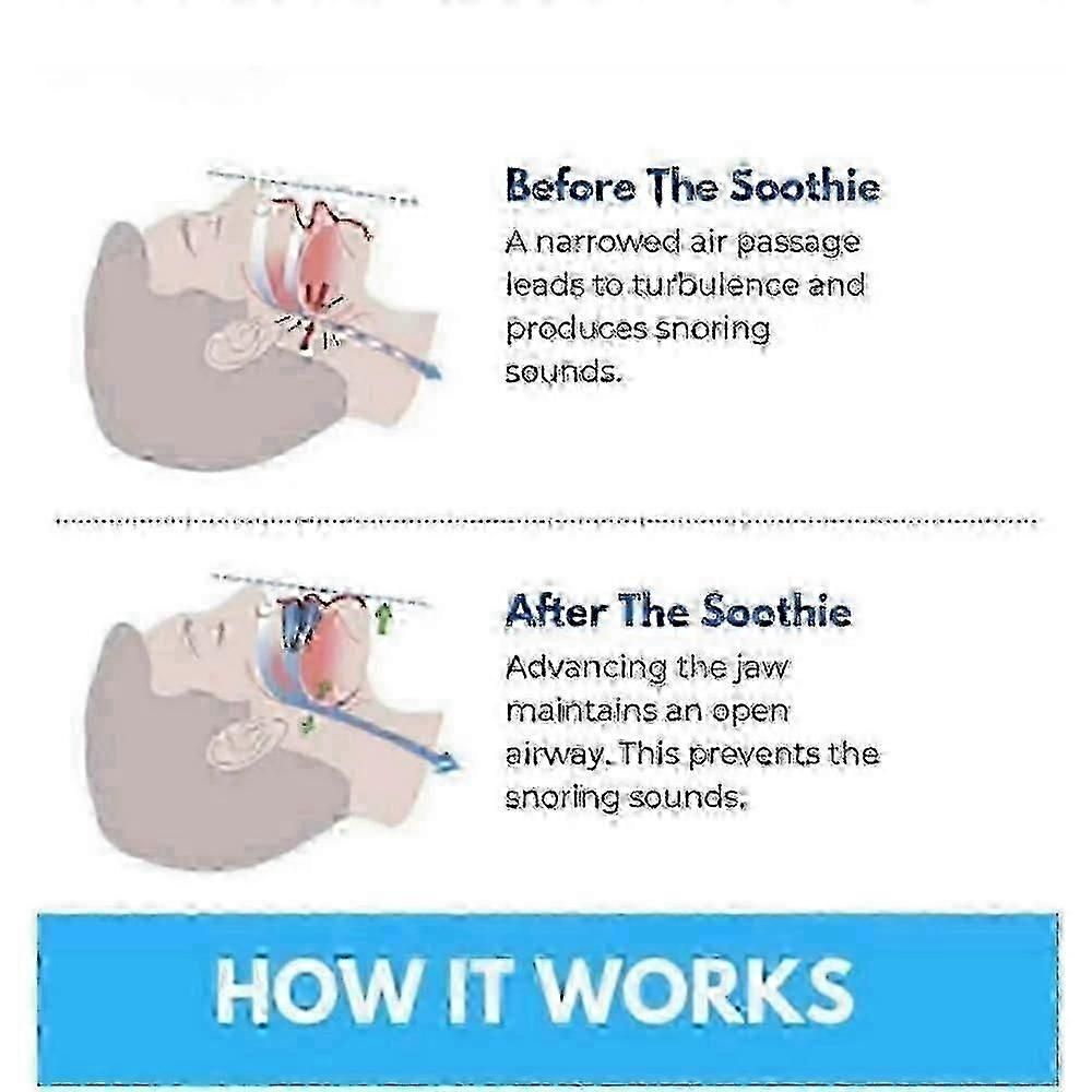 Honex Anti-Snoring Mouthpiece - Quite Night Device, PC+EVA โ image 4