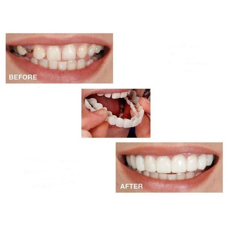 Fake Teeth Denture Teeth Temporary Snap On Veneers Cover The Imperfect Teeth Fix Confident Smile Temporary Fake Teeth — image 2