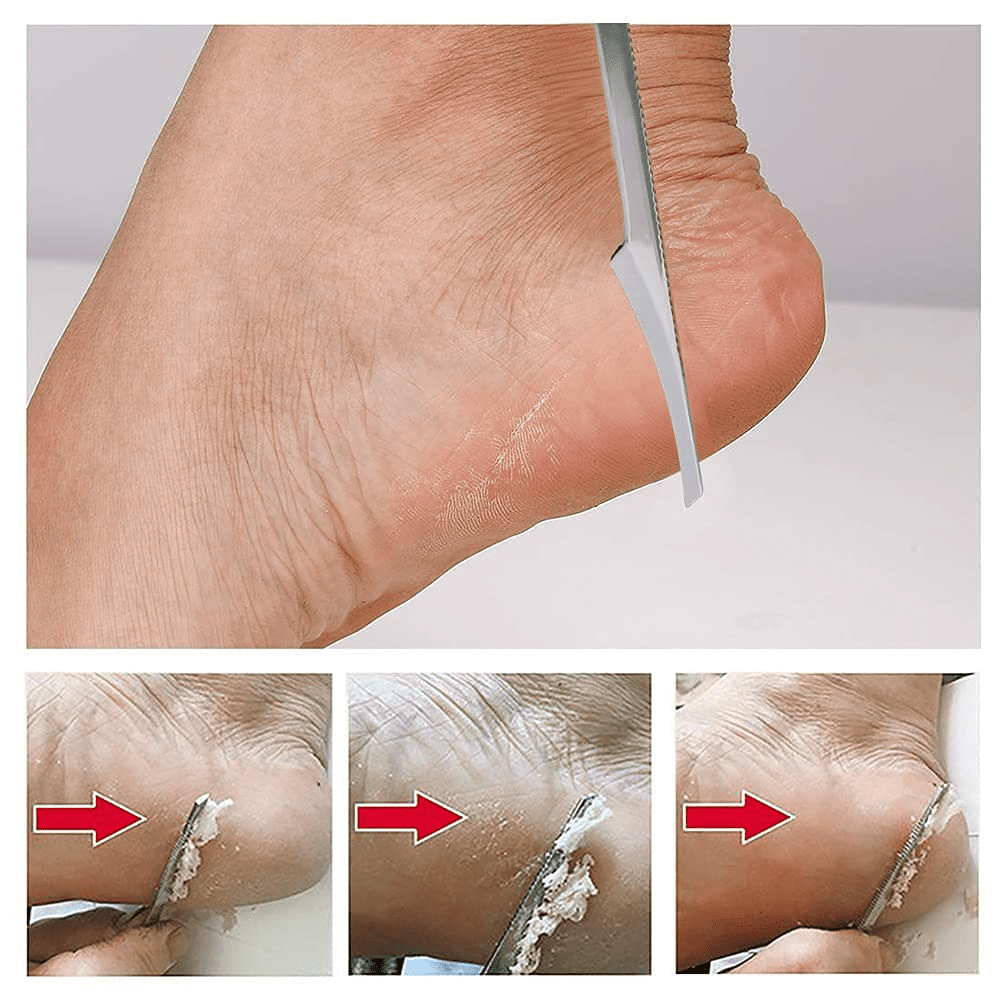 Foot Callus Shaver & Scraper Remover - Callous Removers for Feet Razor Tools with 10 Blades - Professional Pedicure Knife for Heel Hand Skin Care โ image 5