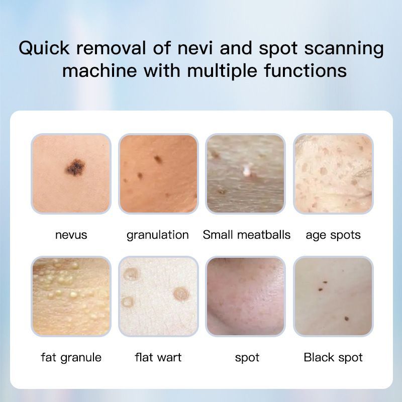 Dotting Mole Pen Nevus Removal Tool Spot Remover Red Blue Light Therapy Beauty
