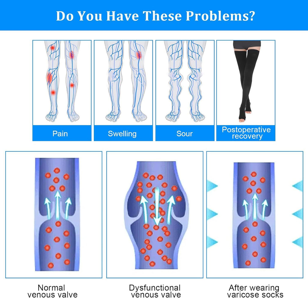 Thigh High Compression Socks for Women Men 23-32 mmHg Open Toe, Level 2 Support for Varicose Veins Edema, Breathable Cotton Spandex with Silicone Dotted Bands