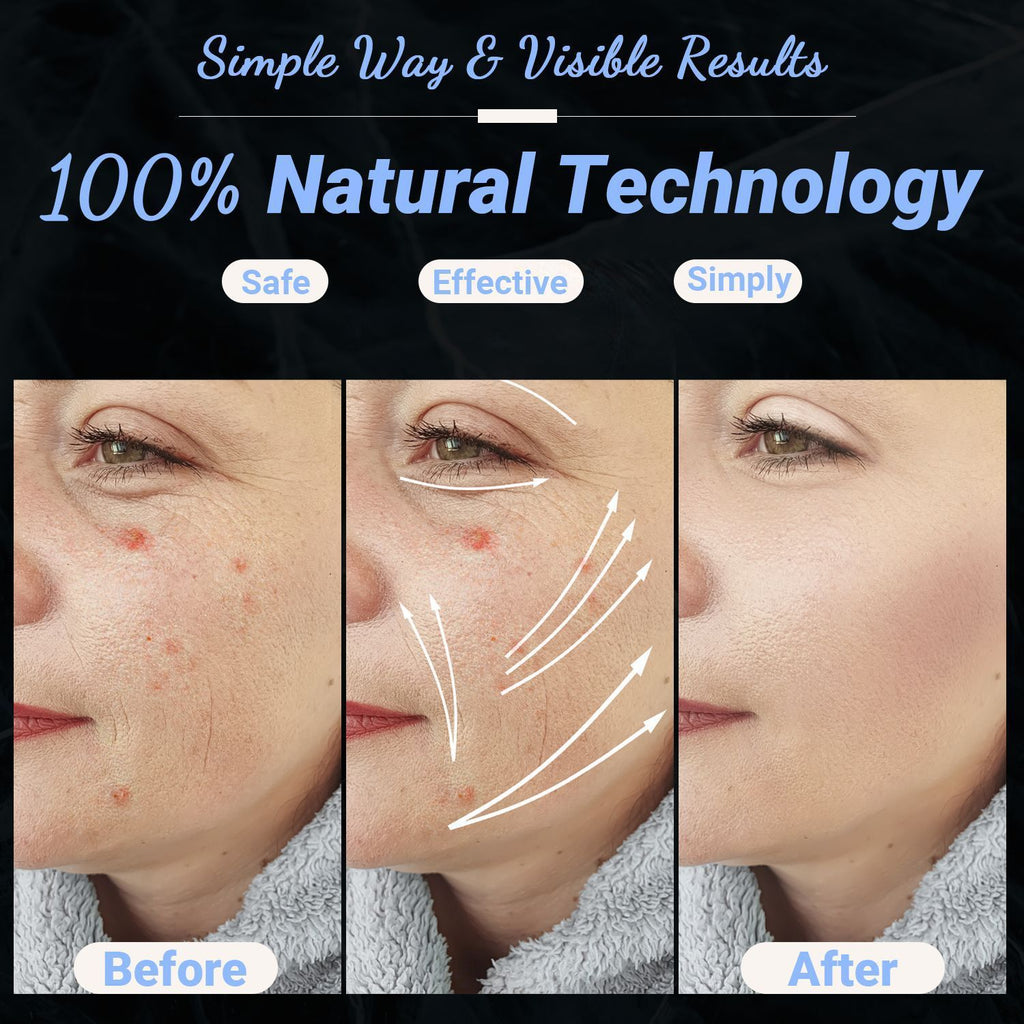 High Frequency Facial Machine - Portable Handheld High Frequency Facial Skin Wand Machine with 4 Different Tubes