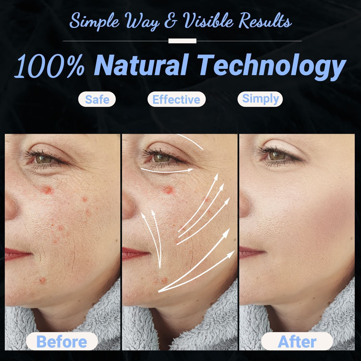High Frequency Facial Machine - Portable Handheld High Frequency Facial Skin Wand Machine with 4 Different Tubes