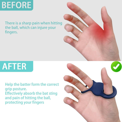 2 Pack Soft Silicone Baseball&Softball Thumb Guards for Shock Absorption, Blister Prevention, Bat Sting Reduction for Swing Training （blue）